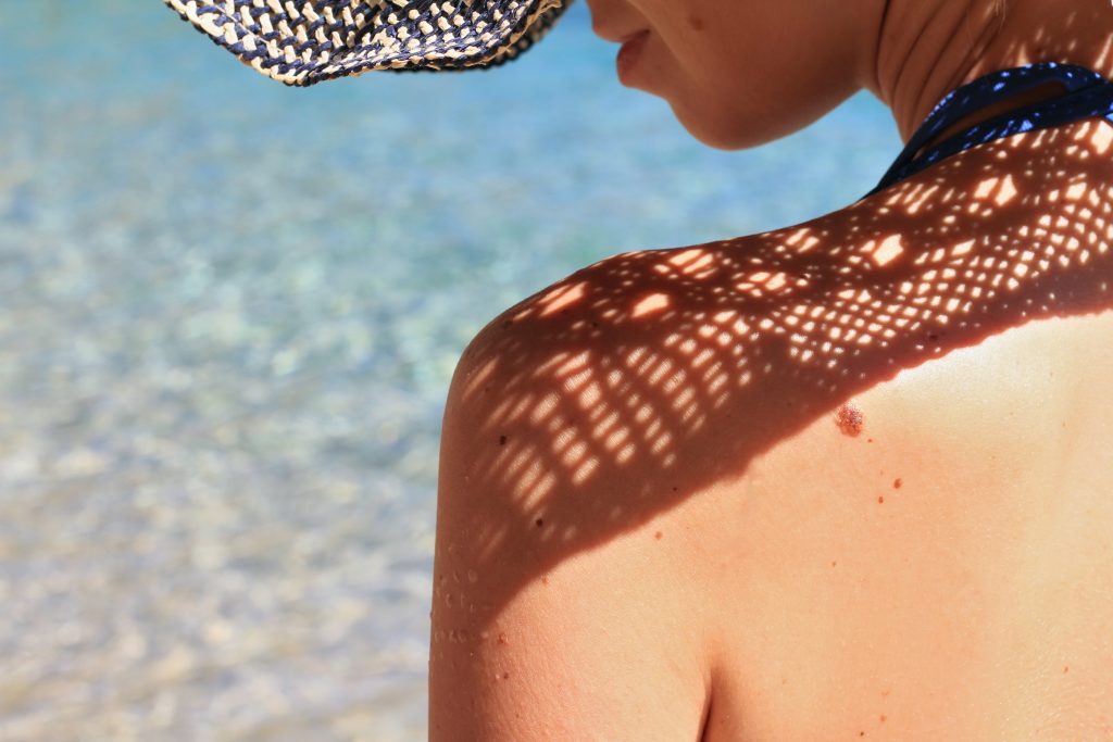 Melanoma: Come Riconoscerlo e Come Prevenirlo?