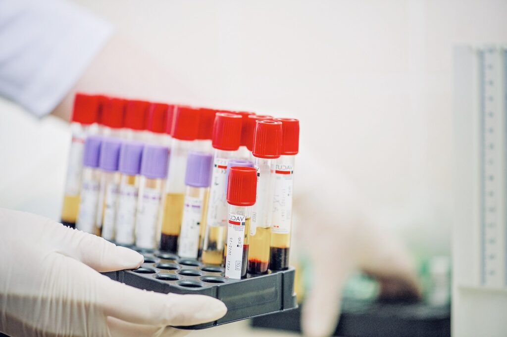 Influenza di stagione: chi sono i destinatari della campagna vaccinale 2020